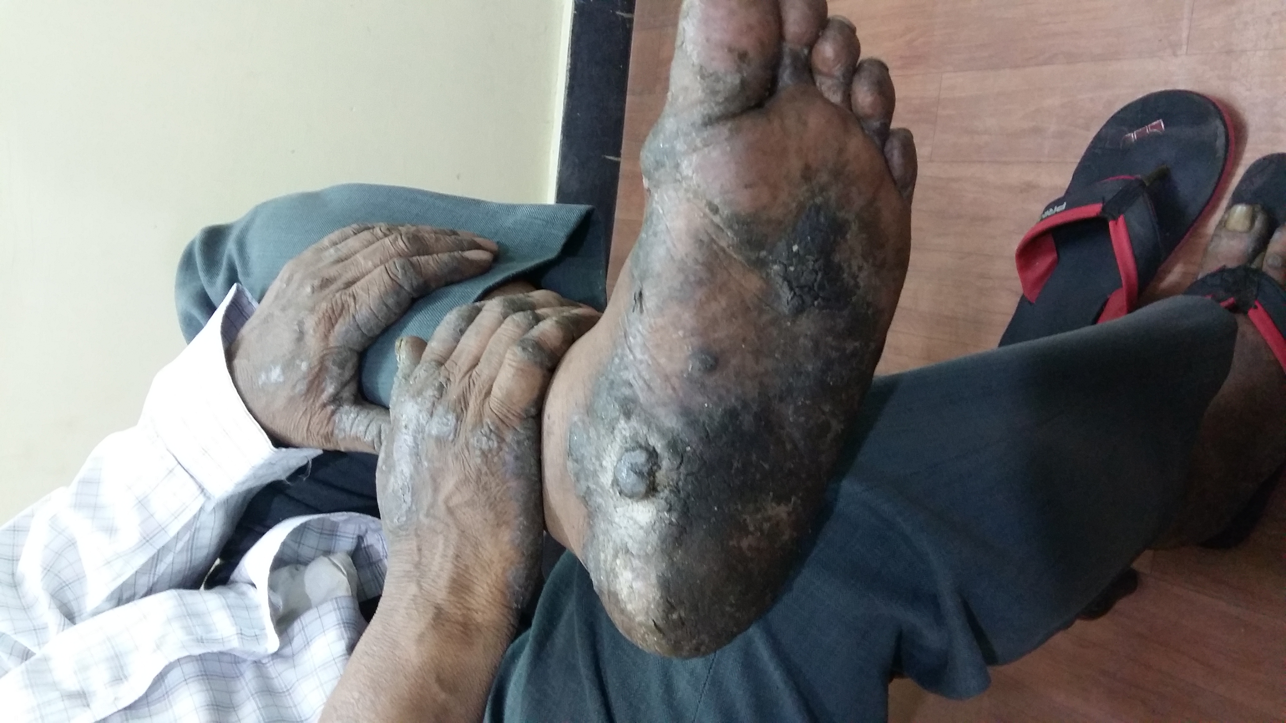 What Is The Diagnosis Of Skin Disease